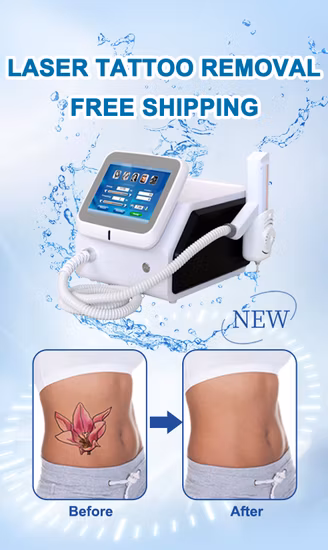 Оборудование для лазерной обработки красоты Q Switched ND YAG Laser Pico Pigment Tattoo Removal Machine